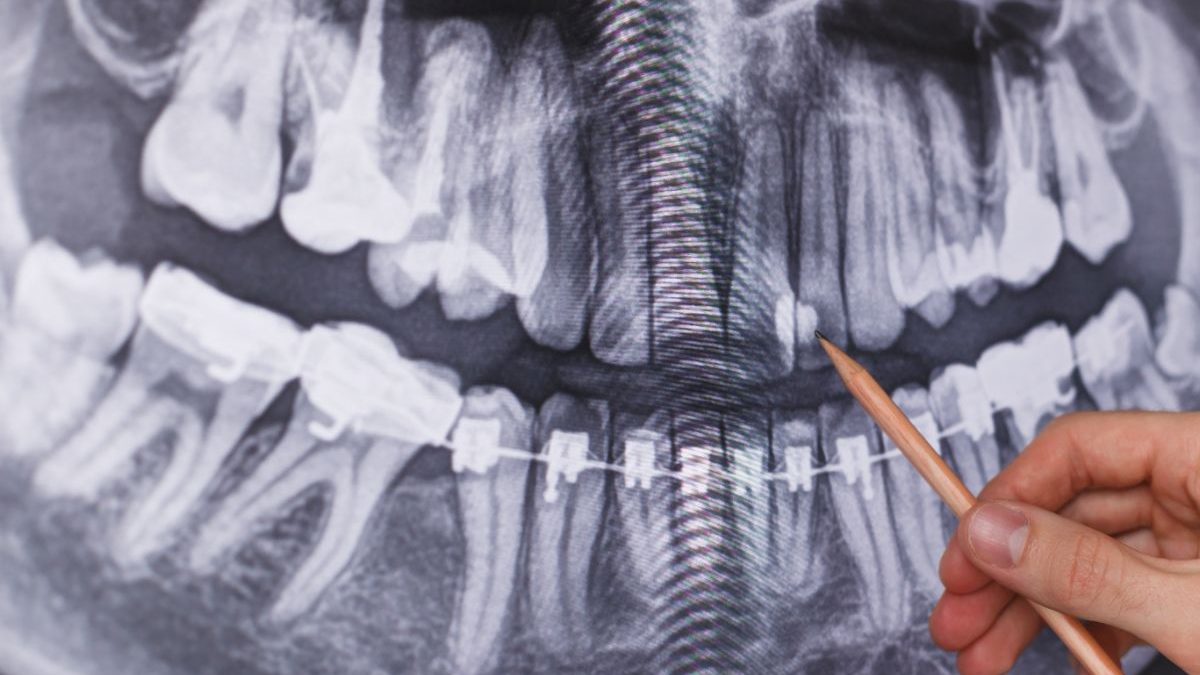 Are dental x-rays necessary